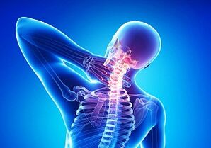 Possible complications with an intersection of osteochondrosis