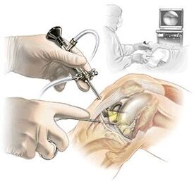 Clarifying the diagnosis of dasal arthrosis medicine
