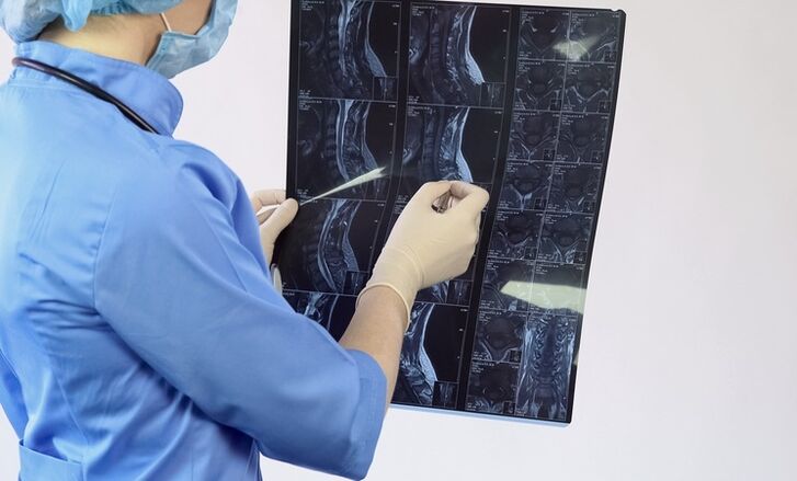 The diagnosis of cervical osteochondrosis is made on the basis of an MRI study